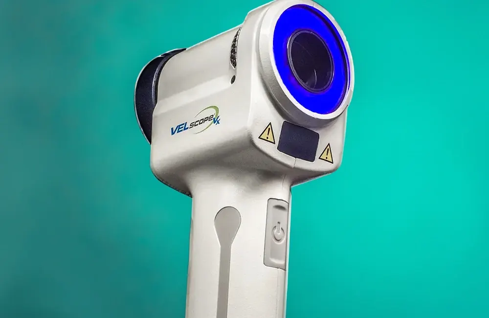 A VELscope oral cancer screening device.